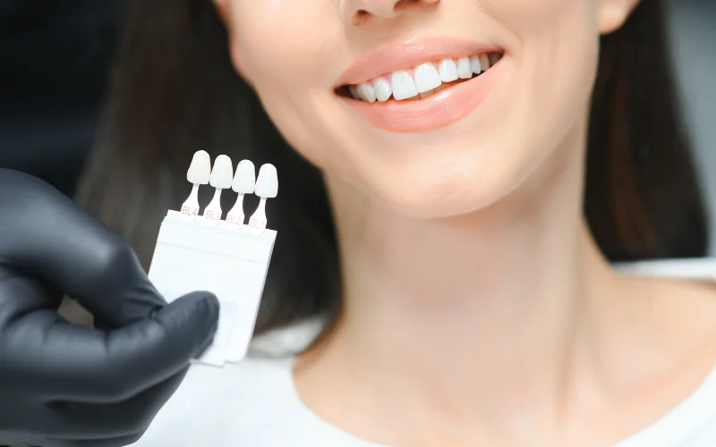 OLIVER DENTAL Y MED SPA Blanquiamiento Dental