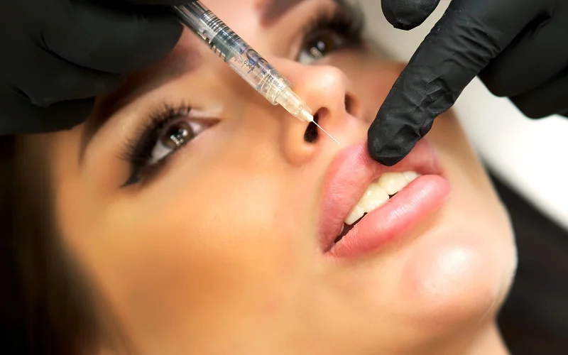 OLIVER DENTAL Y MED SPA Rellenos de Labios Restylane