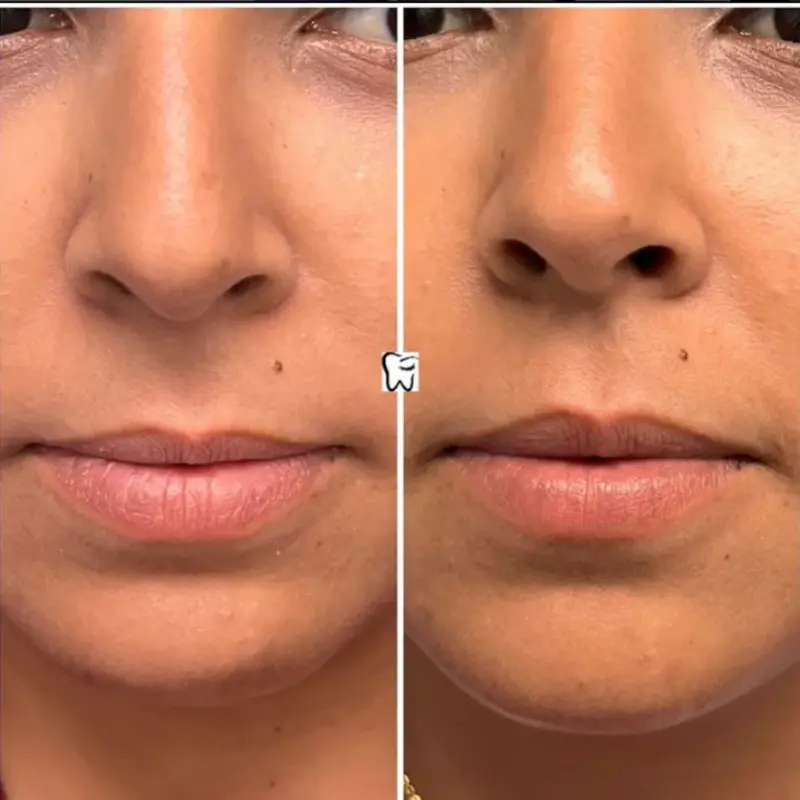 Oliver Dental y Med SPA TESTIMONIOS (11)