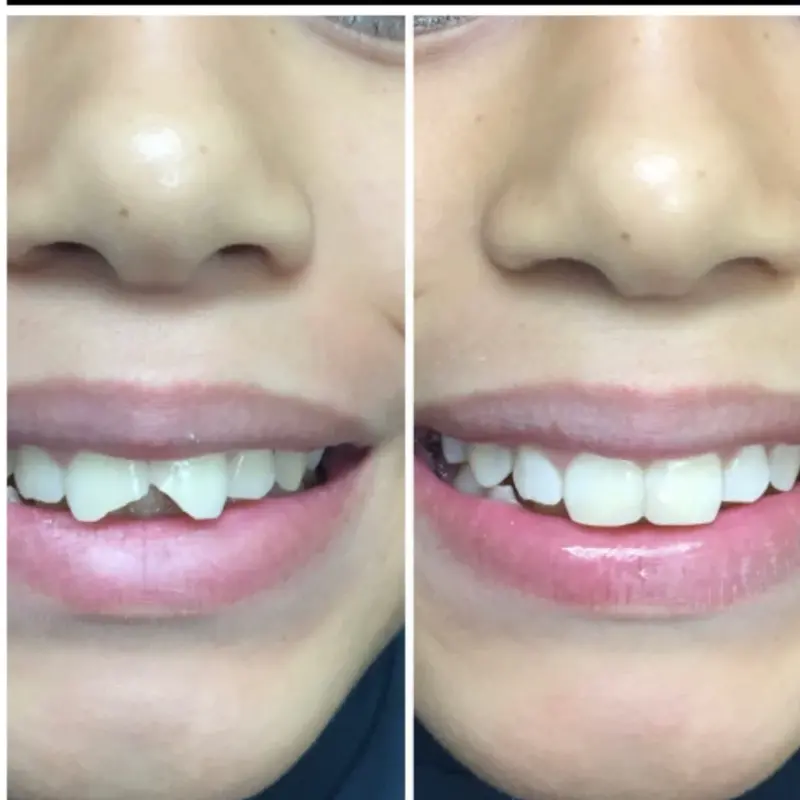 Oliver Dental y Med SPA TESTIMONIOS (12)