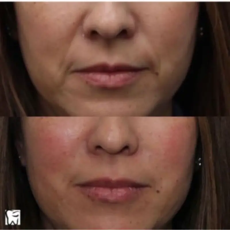 Oliver Dental y Med SPA TESTIMONIOS (3)