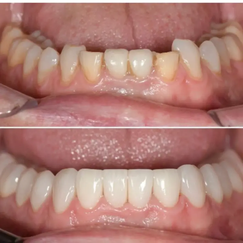 Oliver Dental y Med SPA TESTIMONIOS (5)