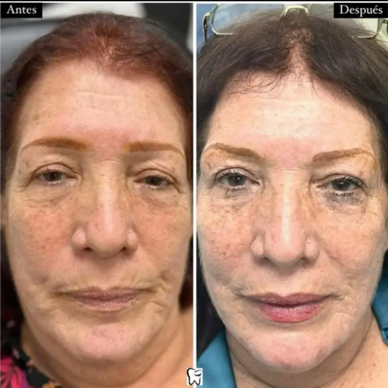 Oliver Dental y Med SPA TESTIMONIOS (8)